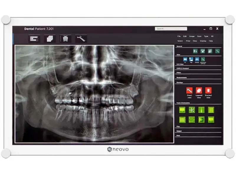 Ag Neovo Dr-2202 22-Inch Dental Lcd Monitor With 5Ms Response Time 1