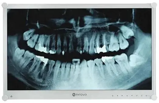 Ag Neovo Dr-24G 24-Inch 1080P Healthcare Monitor For Dental Imaging 1